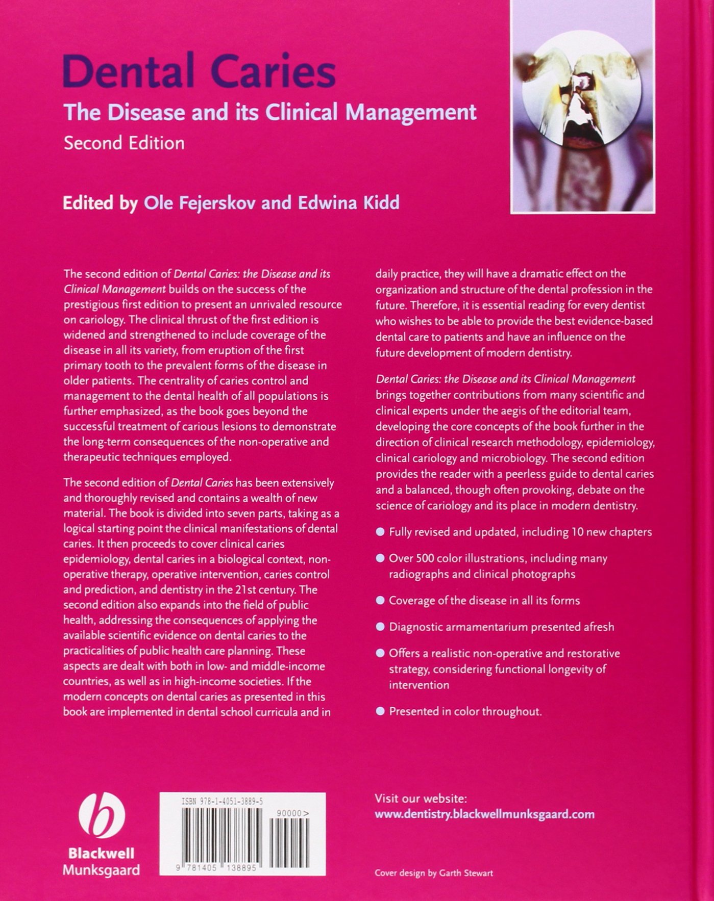 Dental Caries The Disease And Its Clinical Management Second Edition